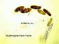 Hysterographium fraxini-amf2034-asques et spores